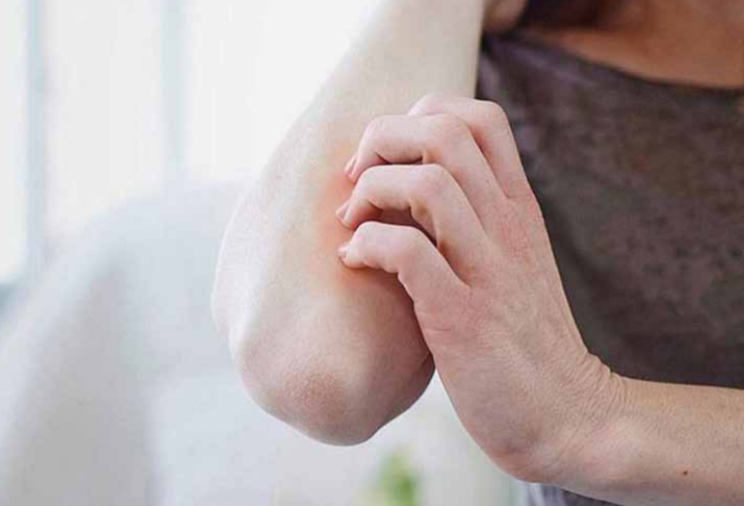 صدفية المفاصل .. مرض غير معدٍ والعلاج المبكر يحد من انتشاره